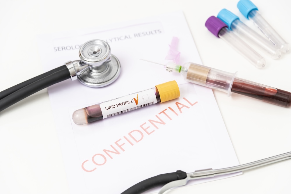 Blutprobenröhrchen mit der Aufschrift „Lipid Profile“ auf einem Dokument mit dem Vermerk „Confidential“, daneben ein Stethoskop, eine Spritze mit Blut und weitere leere Probenröhrchen.