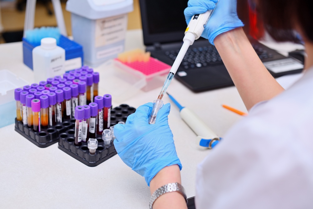 Laboranalyse von Blutproben zur Hormon- und Nährstoffbestimmung